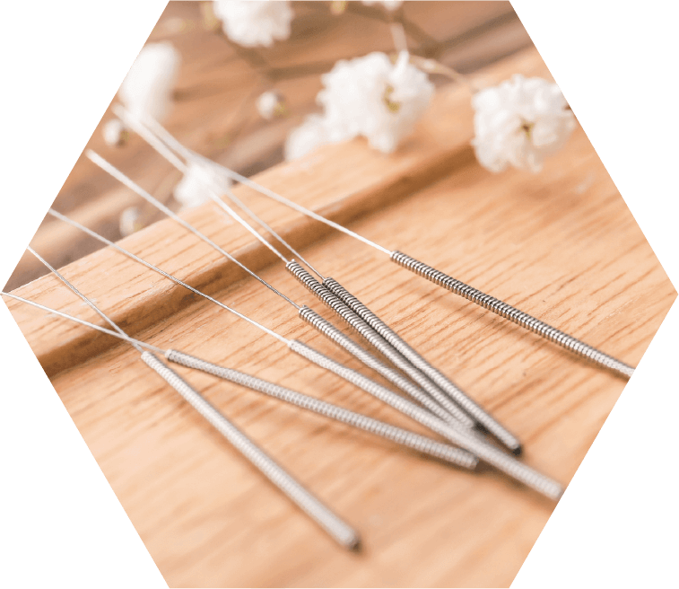 Acupuncture for Menopause Airdrie